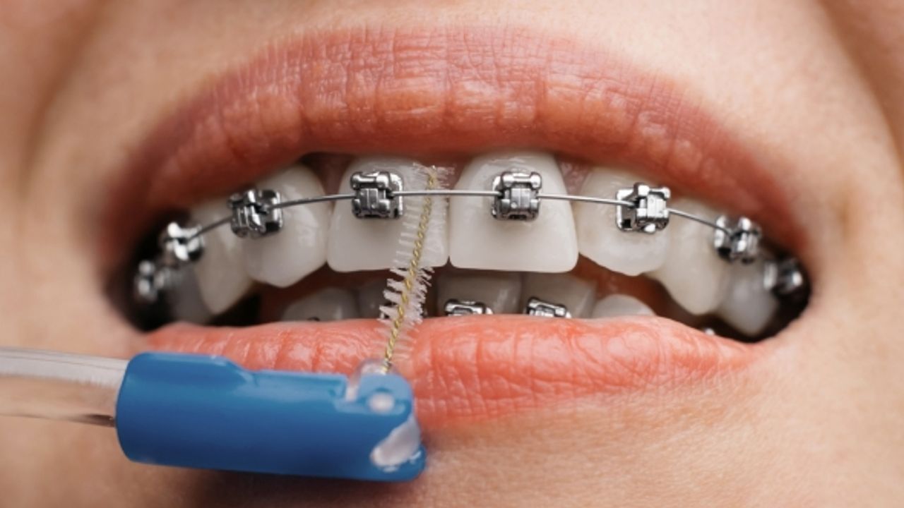 Arven Diş Ağız Ve Diş Sağlığı Polikliniği